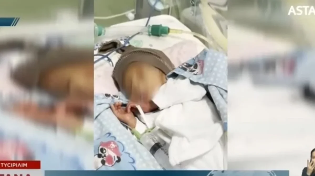 Атырауда дәрігерлер анасы тастап кеткен сәбиге қырқынан шығару рәсімін жасады