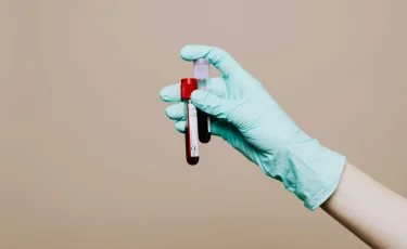 Больше 100 жителей заразились ВИЧ в Акмолинской области