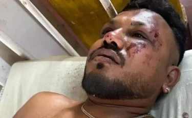 «Есімді жиғанда айналамда мәйіттер жатты»: 242 жолаушысы бар ұшақ апатынан бір адам ғана тірі қалды