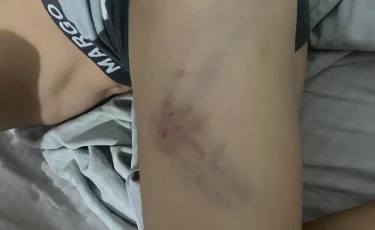 «Ломали пальцы, били, обжигали»: в деле избиения мальчика в Балхаше фигурирует сотрудник «Казахмыса»