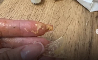 «Ауызым қанға толды»: Бойжеткен донерден әйнектің сынығын тауып алған