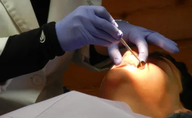 Частные стоматологии рискуют здоровьем детей: Минздрав начал массовые проверки